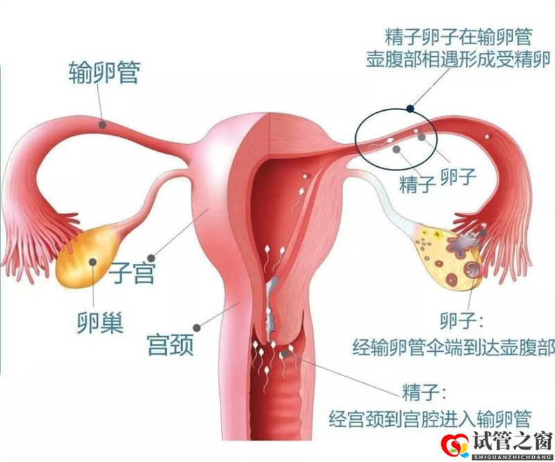 做试管婴儿前，必须知道的6个真相(图1)