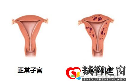 33岁子宫畸形多年未孕,如何提高试管成功率(图2)