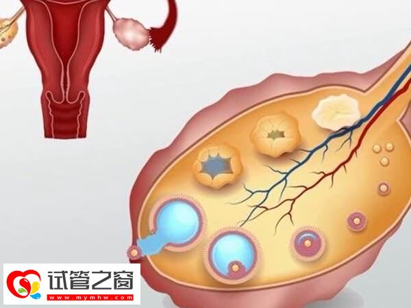 单角子宫做试管成功率如何