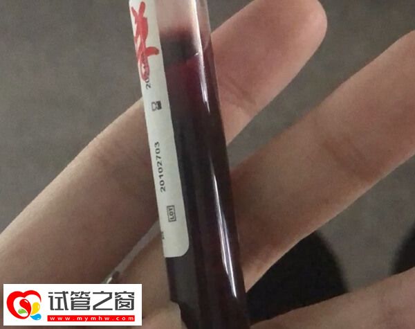 做试管期间要控制好血糖